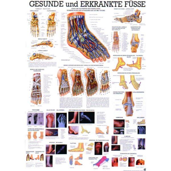 Tafel "Gesunde und erkrankte Füße"
